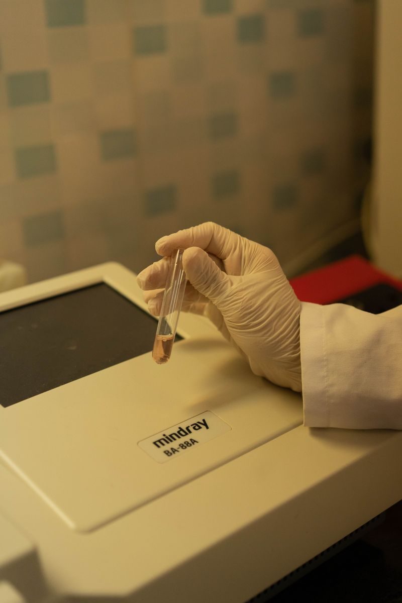 Lab technician's gloved hand holding a vial near a semi-automatic chemistry analyzer.