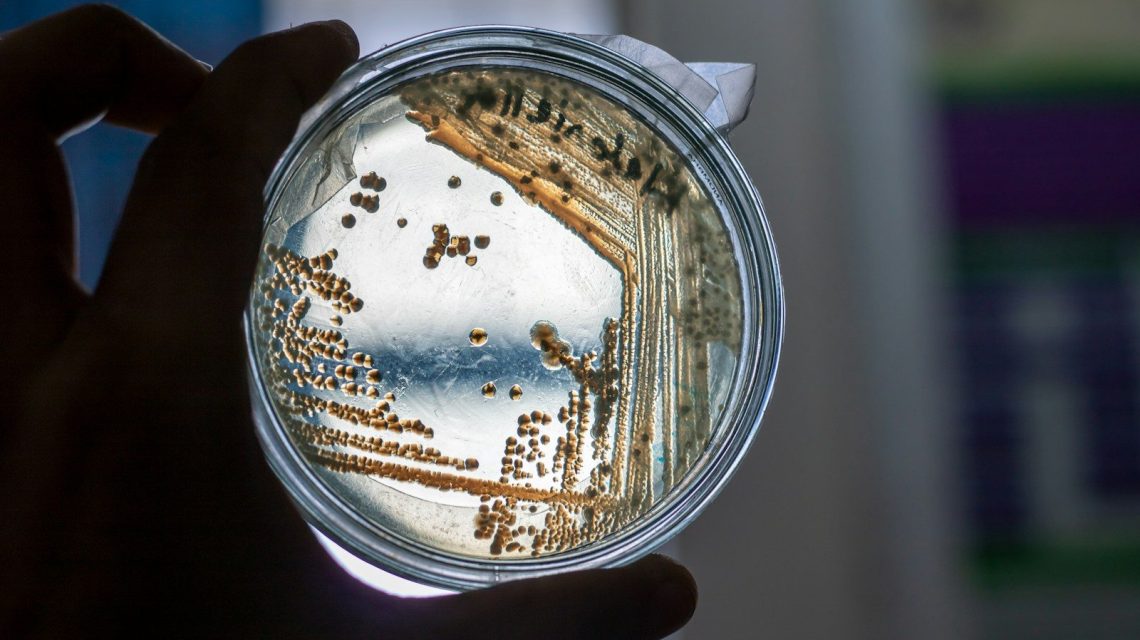 A petri dish with bacteria cultures