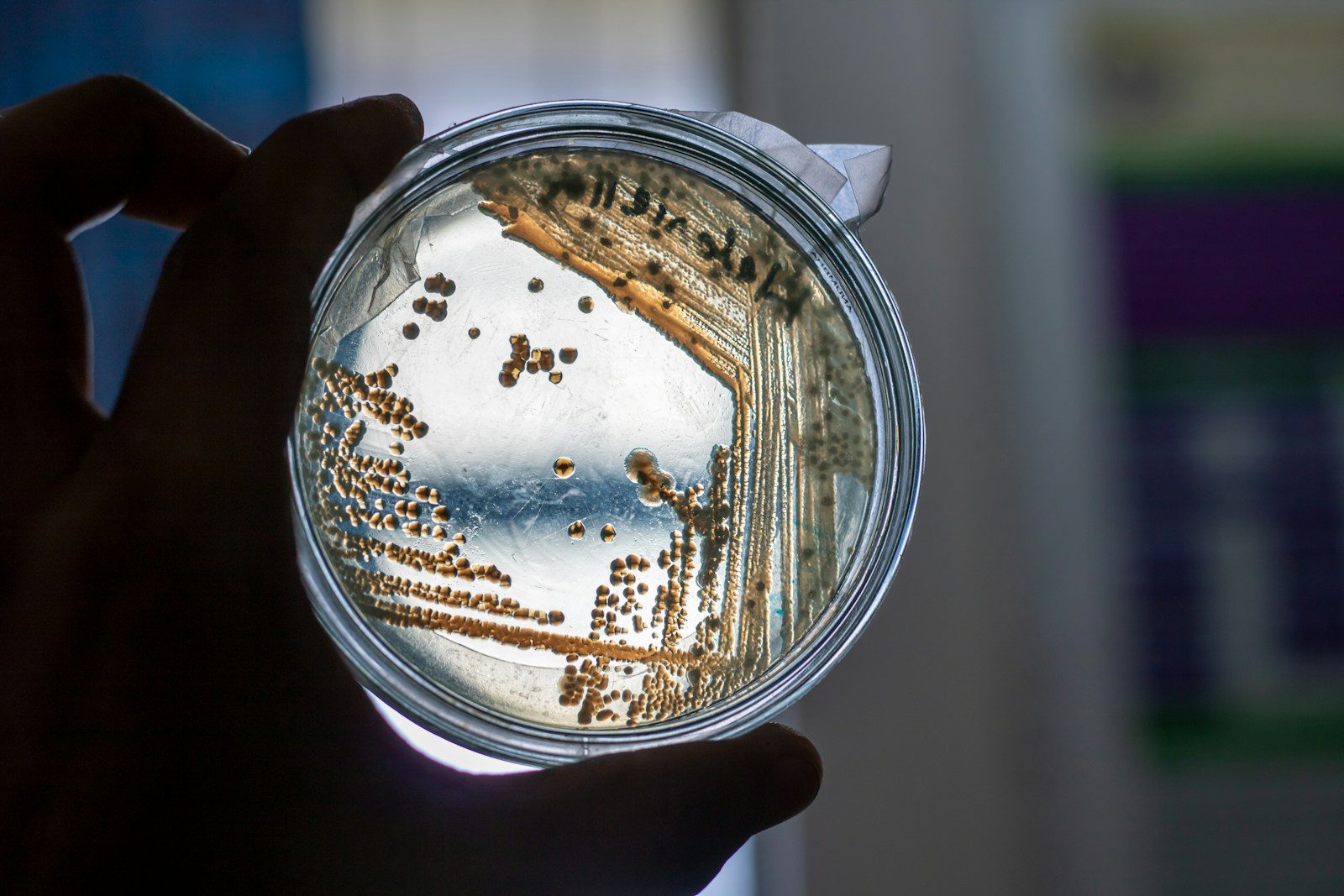 A petri dish with bacteria cultures
