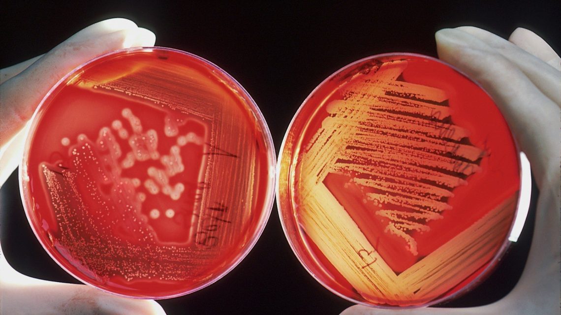 a pair of hands holding a red petri dish