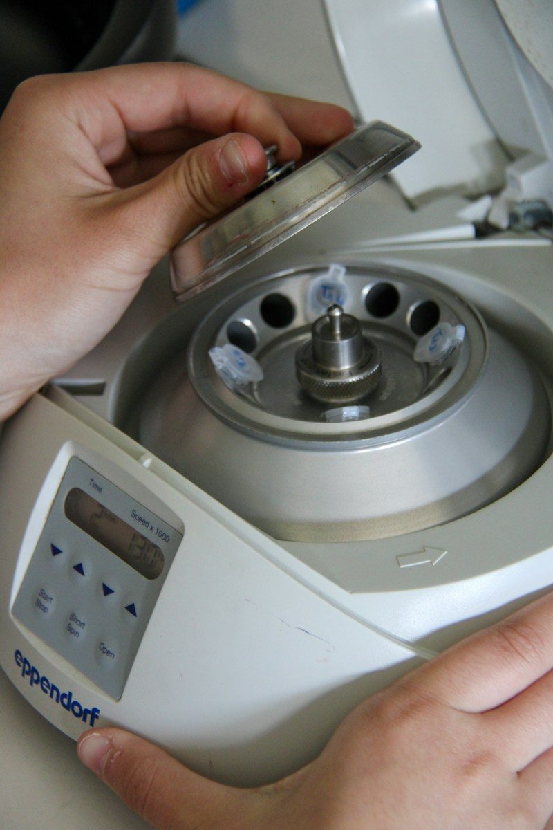 A hand is opening a centrifuge machine