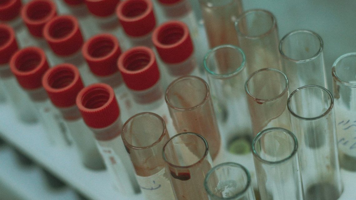 a group of beakers with red and white liquid in them